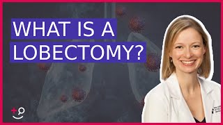 What Is a Lobectomy? Dr. Cassidy on Lung Cancer Removal