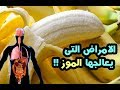 فوائد الموز للحامل والجنين والامراض التى يعالجها الموز !!