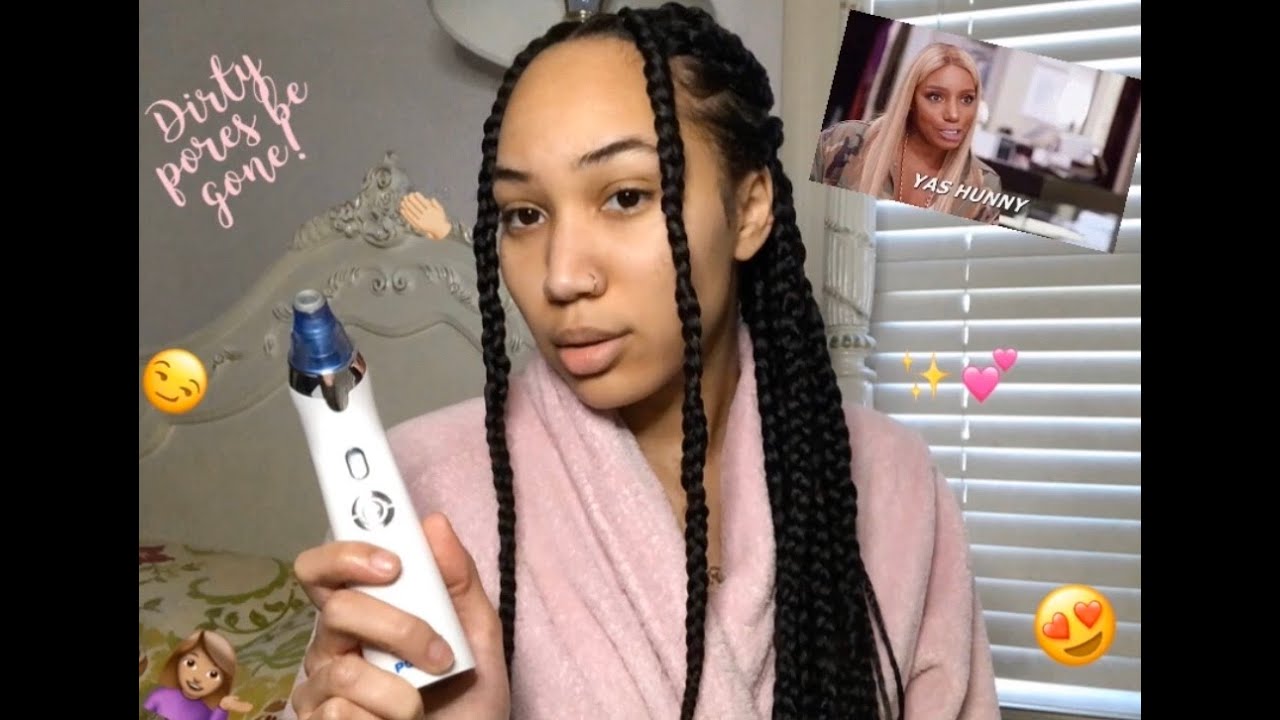 Does dermasuction actually work? | Dermasuction review!!