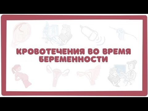 Кровотечения при беременности (акушерство гинекология лекции)