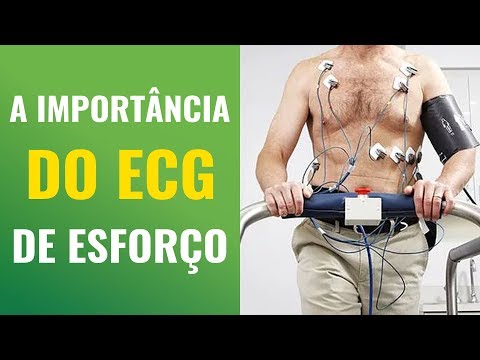 A IMPORTÂNCIA DO ECG DE ESFORÇO NOS EXERCÍCIOS.