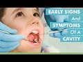 What Are The Early Signs And Symptoms Of A Cavity?