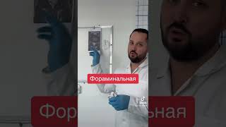 Фораминальная межпозвоночная грыжа диска