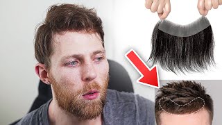 Are Frontal / Partial Hair Systems Trash?