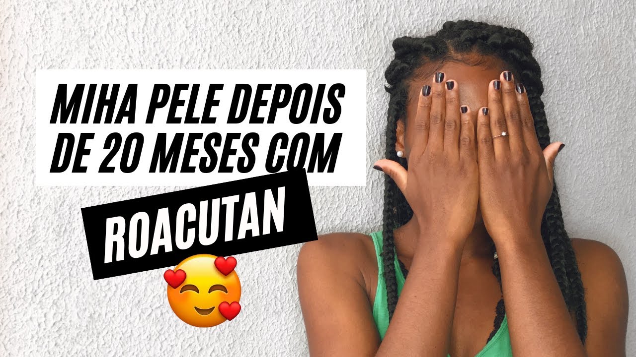 TOUR PELO MEU ROSTO 20 Meses Com ROACUTAN YouTube
