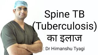 रीढ़ की हड्डी टीबी का इलाज/ Spine tuberculosis treatment