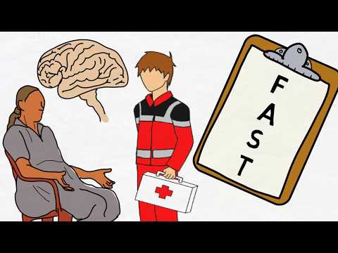 Video: Schlaganfallsymptome: Verwenden Der FAST-Methode Und Mehr