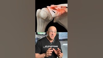 Shoulder Separation 🦾 AC Joint Dislocation #shorts