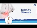 Kidney stones  symptoms treatment and prevention  dr shafiq ahmed