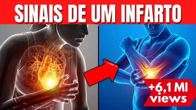 INFARTO: SINAIS QUE O CORPO DÁ SEMANAS ANTES DE ACONTECER - Blog