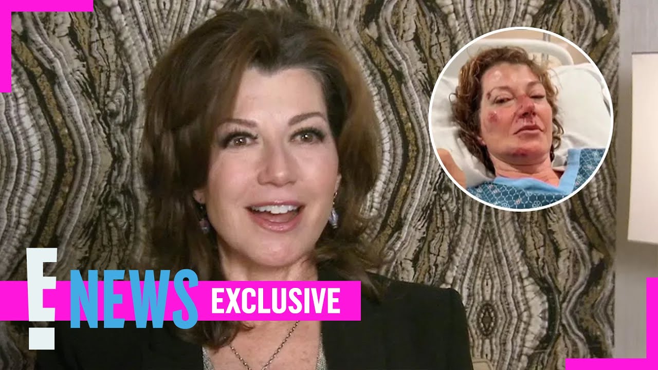 Amy Grant Got an ACCIDENTAL Face-Lift While Recovering From Bike Wreck (Exclusive) | E! News