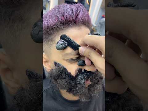 ازالة الحباية المتسلطنة من القوره
