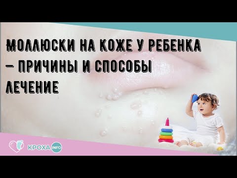 Как удалить моллюск в домашних условиях у ребенка