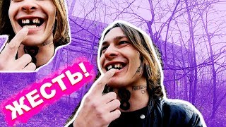 У АНТОНА МАРЧУКА Выпал ПЕРЕДНИЙ ЗУБ! (ЭТО ОЧЕНЬ СМЕШНО) ★ screenshot 2