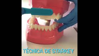 Técnica Starkey De Cepillado
