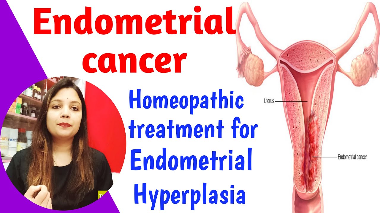 बच्चेदानी का कैंसर | Endomerteial Carcinoma, Hyperplasia | Homeopathic Treatment for Uterine Cancer|