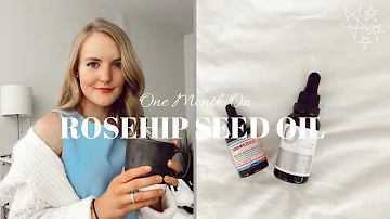 ONE MONTH ON ROSEHIP SEED OIL | here's what happened