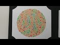 Video 6: The Ishihara Test for Colour Vision