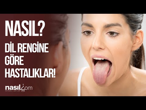 DİL RENGİNİZ BU HASTALIKLARIN HABERCİSİ OLABİLİR! İŞTE DİL RENKLERİ VE ANLAMLARI! #hastalık #dil