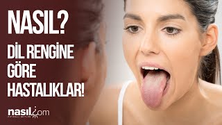 DİL RENGİNİZ BU HASTALIKLARIN HABERCİSİ OLABİLİR! İŞTE DİL RENKLERİ VE ANLAMLARI! #hastalık #dil