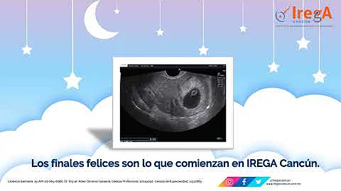 Embarazo Gemelar - IREGA Cancún