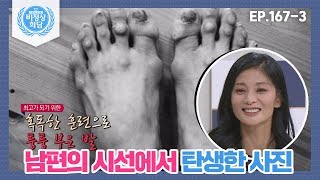 [비정상회담][167-3] 남편의 시선에서 탄생한 사진☞혹독한 훈련으로 퉁퉁 부은 강수진의 발 (Abormal Summit)