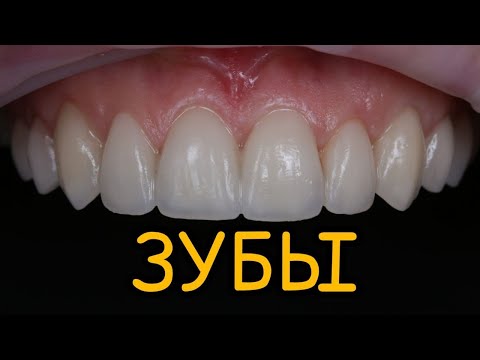 К чему снятся ЗУБЫ. К чему снится что ВЫПАЛ зуб. Толкование сна. Сонник.