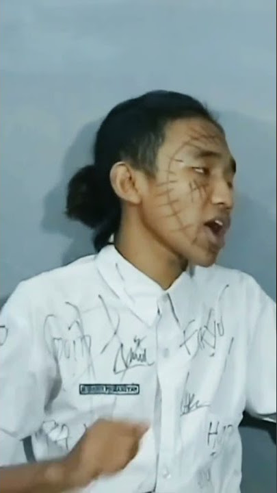 stm pentol