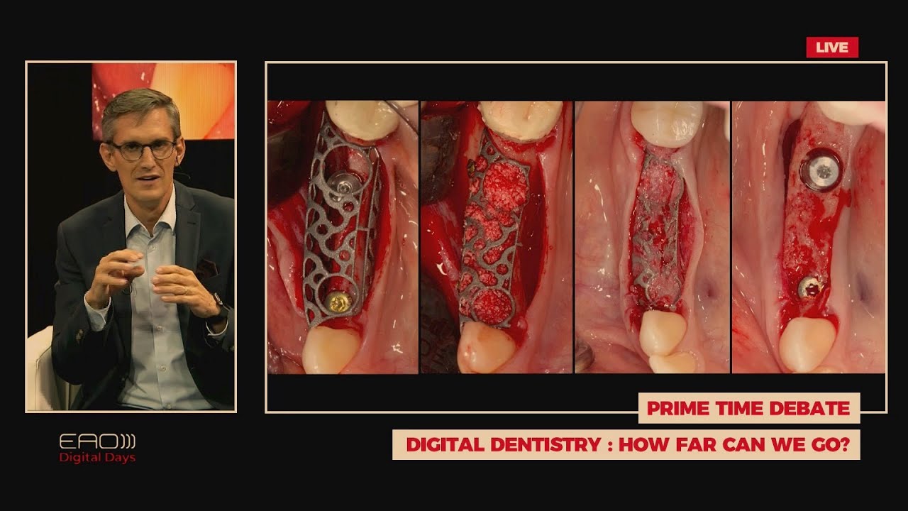 Цифровая стоматология Как далеко мы можем зайти Франк Ренуар Б Клинге С Мюхельманн С Вольфарт