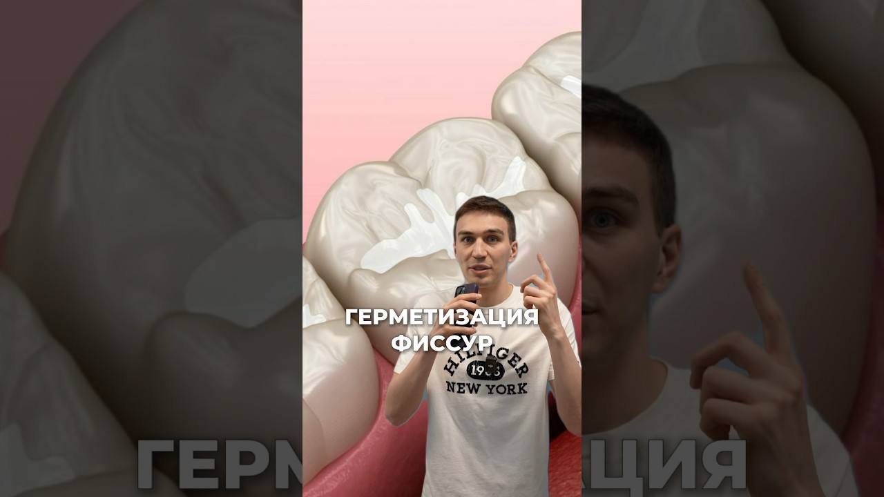 Герметизация фиссур