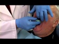 Ivoclar vivadent centric tray with dr frank lauciello