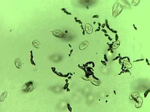 Infusoria Culture, freshwater rotifers, discus fry feeding, rotifers ...