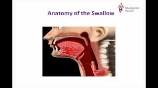 Stroke Education  Dysphagia