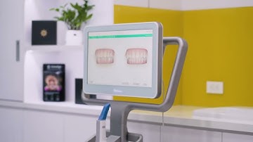 TRẢI NGIỆM MIỄN PHÍ CÔNG NGHỆ ITERO ELEMENT 5D - BIẾT TRƯỚC KẾT QUẢ SAU KHI NIỀNG RĂNG INVISALIGN