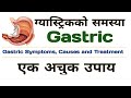 ग्यास्ट्रिकको समस्या बाट अब छुटकारा पाउनुहोस्।
