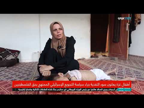 غزة: تدهور صحة الأطفال وتفاقم أزمة سوء التغذية