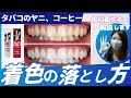 【解説】歯の黄ばみ、着色の落とし方！