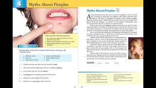 Unit 4 Myths About Pimples