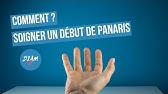 Comment Soigner Un Ongle Incarne Ou Un Panaris Youtube
