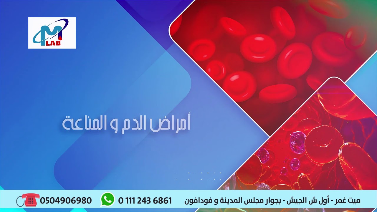 #Motion_video For Dr. Mohamed Ibrahim Lab. - YouTube