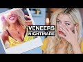 My Horrific Experience With Veneers | The Truth