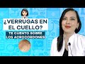 Verrugas en el cuello? quizá no lo son, te cuento sobre los acrocordones