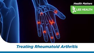 Treating Rheumatoid Arthritis