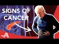 Early Signs of Pancreatic Cancer