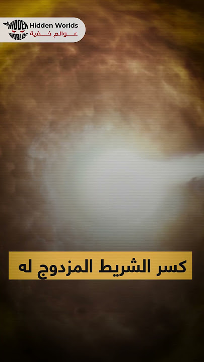 أخطر أنواع الأشعة ..اياك التعرض لها