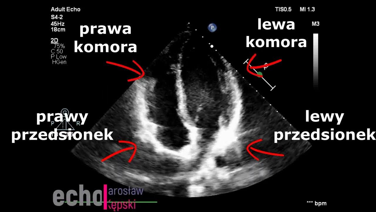 Gdy W Sercu Tęsknota Sprawdzian Budowa serca w echokardiografii USG Serca, Kardiolog, Echocardiography