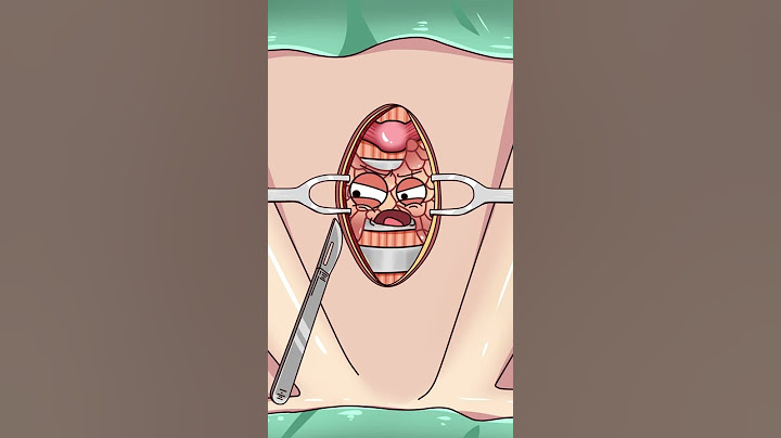 這次把氣管切開看看？tracheotomy - 天天要聞