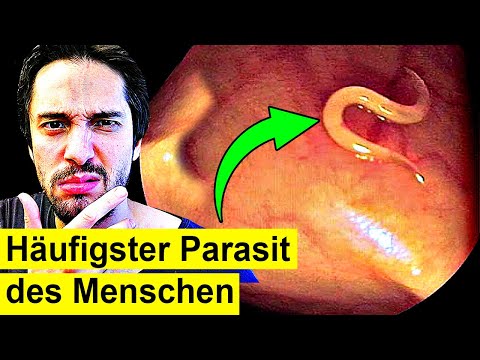 Video: Haben Nematoden eine spiralförmige Sp altung?