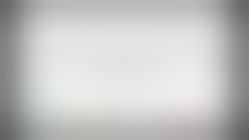 Laparoscopic Wedge Resection of a Gastrointestinal Stromal Tumor (GIST) of the Stomach