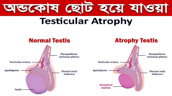 Porno daphne rasmlar Rus tilida Dorcel